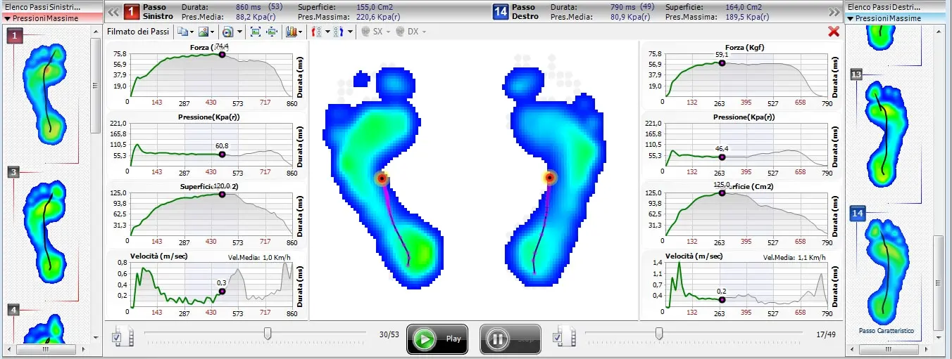 bnr_esamebaropodometrico